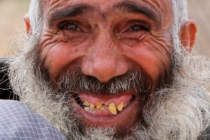 Happy Zahnschmerz-Tag! Die irrsten Rekorde mit Zähnen